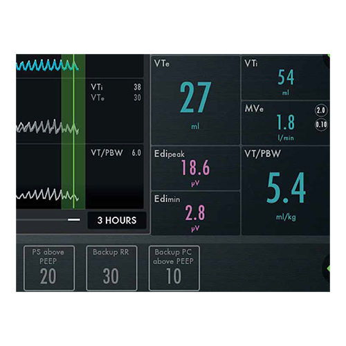 Maquet-Servo-U-Display